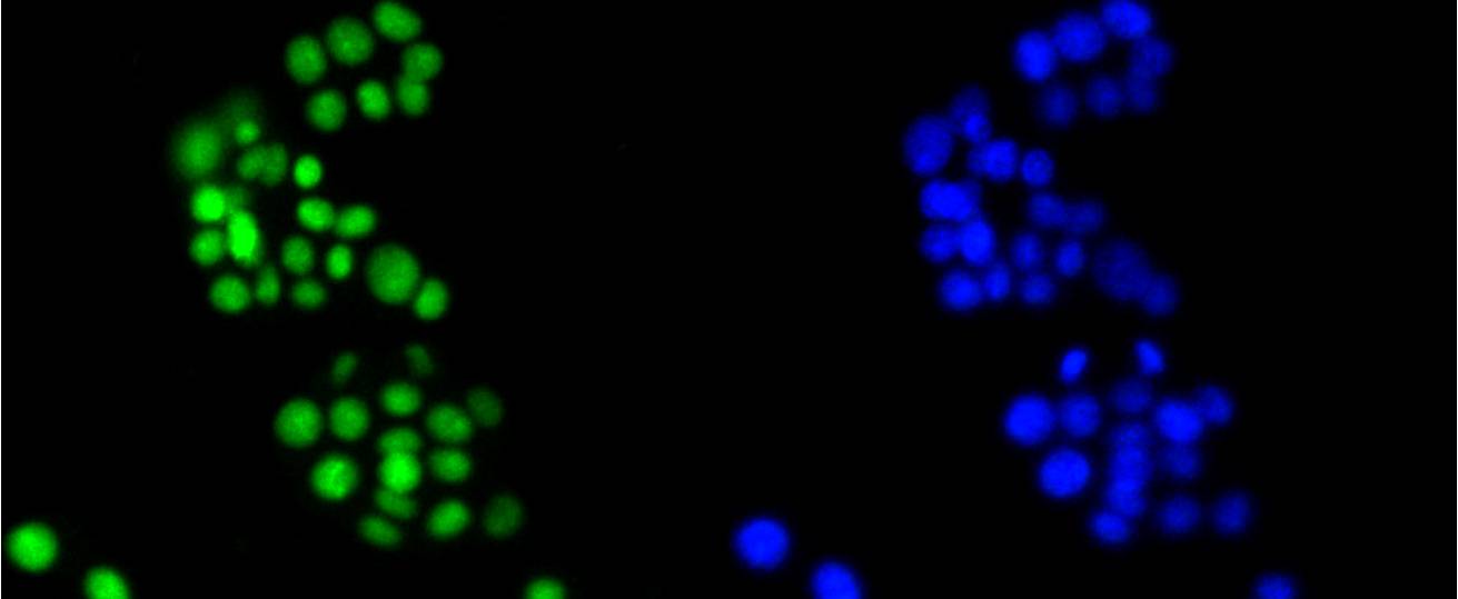 HMGB1 Rabbit mAb