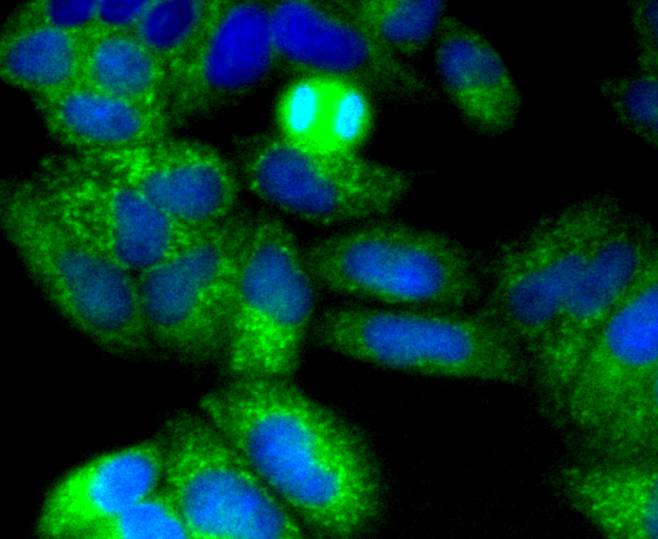 p75 NGF Receptor Rabbit mAb