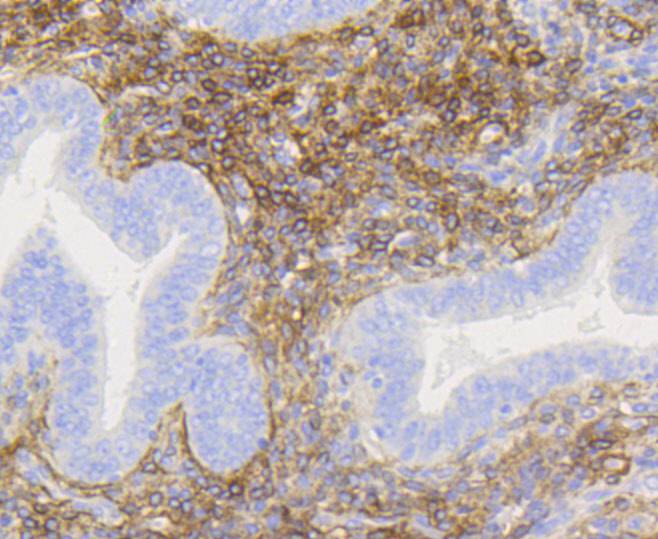 p75 NGF Receptor Rabbit mAb