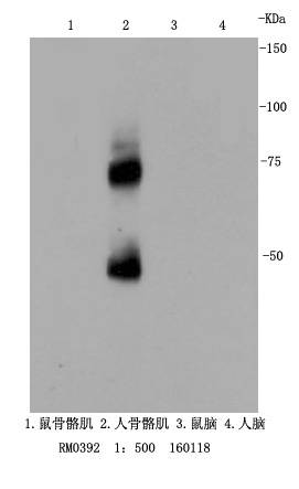 p75 NGF Receptor Rabbit mAb