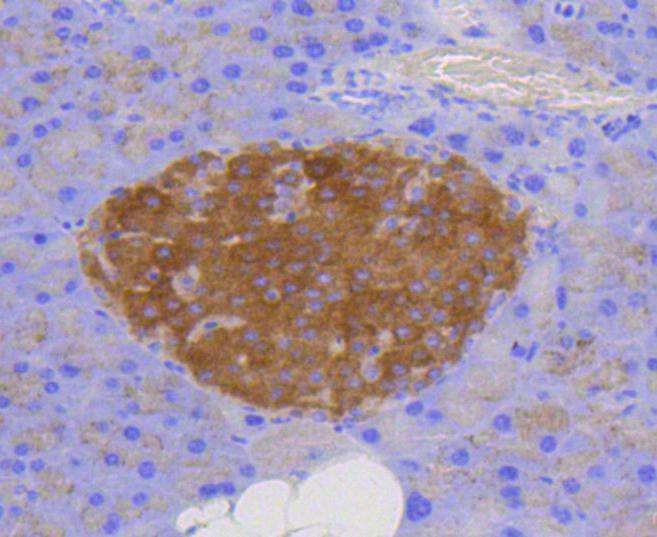 LAMP2a Rabbit mAb