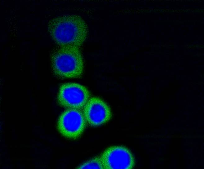 RPS3 Rabbit mAb