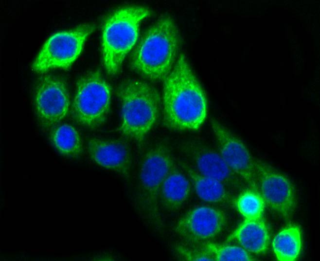 Cytokeratin 20 Rabbit mAb