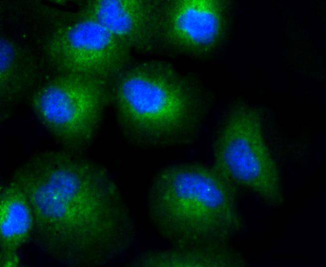 Collagen XVII Rabbit mAb