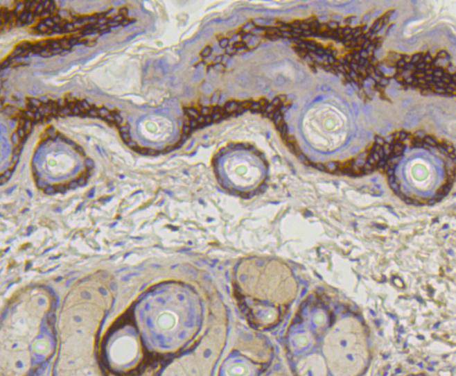 Collagen XVII Rabbit mAb