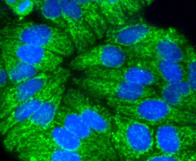 Cytokeratin 17 Rabbit mAb