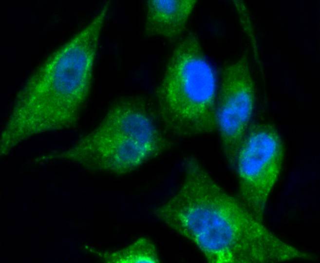 Cytokeratin 17 Rabbit mAb