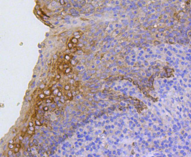 Cytokeratin 17 Rabbit mAb