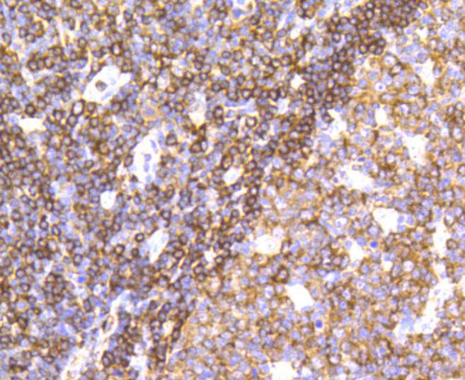 SHP1 Rabbit mAb