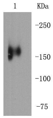 MERTK Rabbit mAb