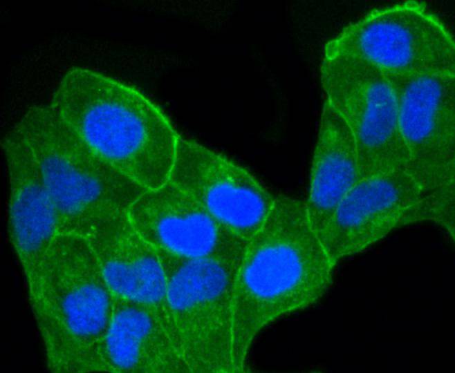 CCR7 Rabbit mAb