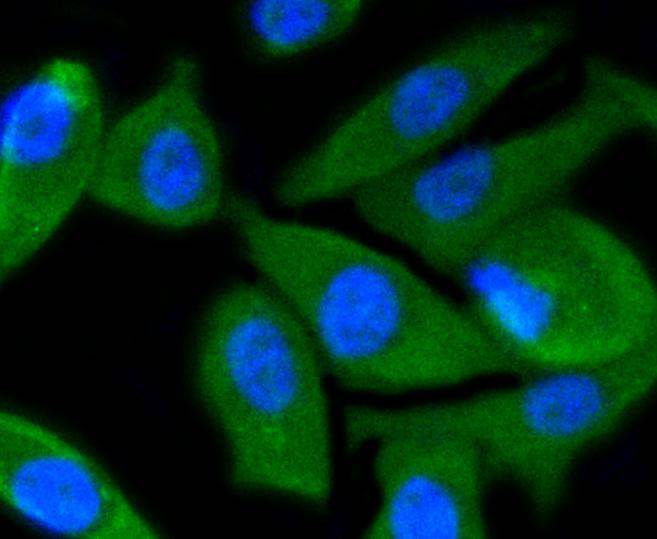 PI 3 Kinase p55 gamma Rabbit mAb