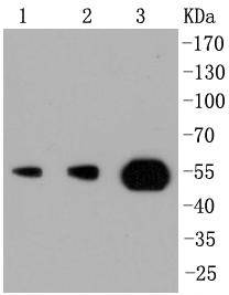 PI 3 Kinase p55 gamma Rabbit mAb