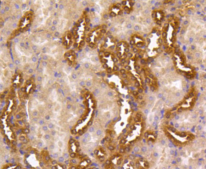 MEK1/2 Rabbit mAb