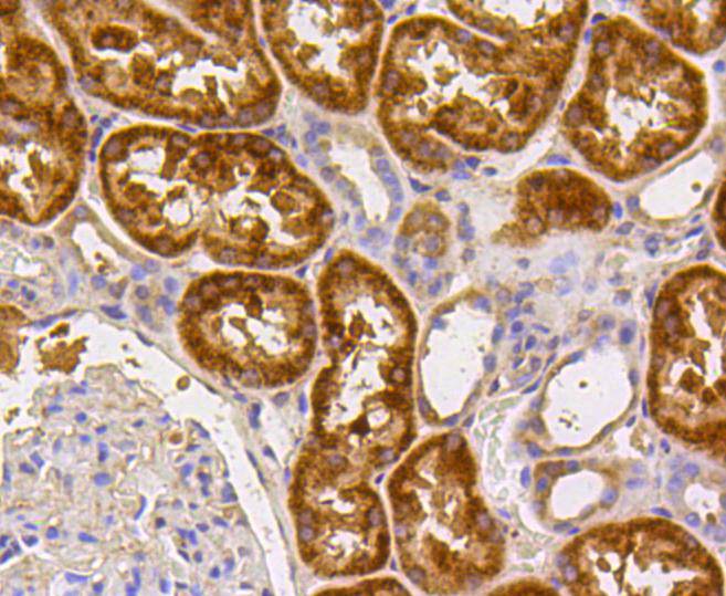 Caspase-2 Rabbit mAb