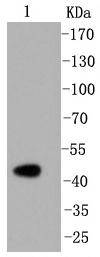 Caspase-2 Rabbit mAb