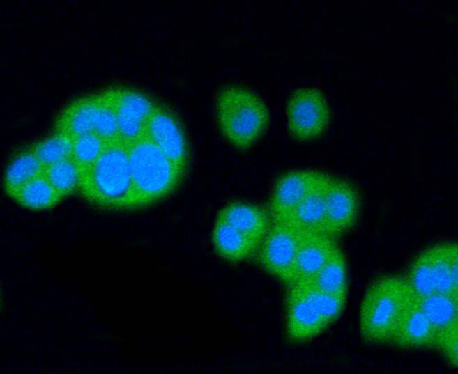 Scavenging Receptor SR-BI Rabbit mAb