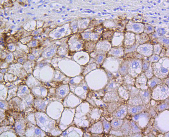 Scavenging Receptor SR-BI Rabbit mAb