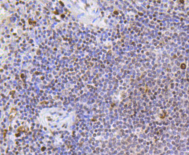 Scavenging Receptor SR-BI Rabbit mAb