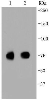 Scavenging Receptor SR-BI Rabbit mAb