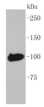 Maltose Binding Protein Rabbit mAb