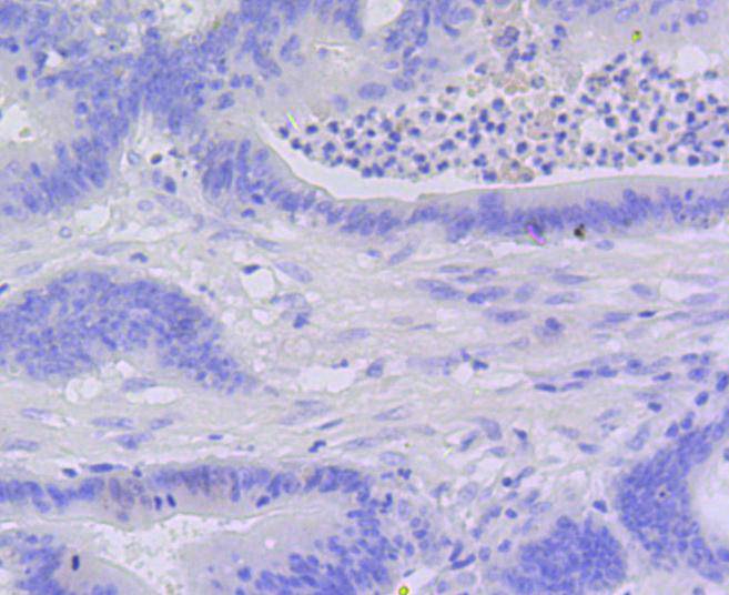 Active Caspase-3 Rabbit mAb