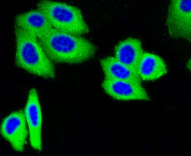 M6PR Rabbit mAb