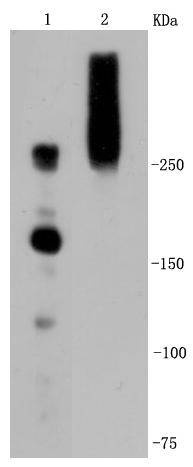 M6PR Rabbit mAb