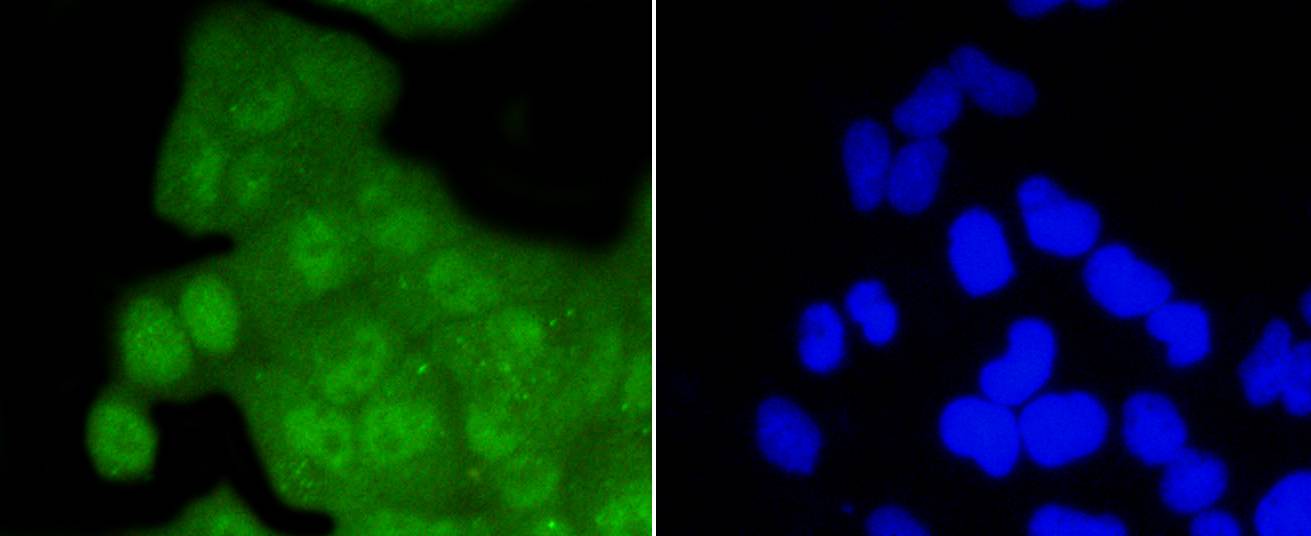 Cdk2 Rabbit mAb