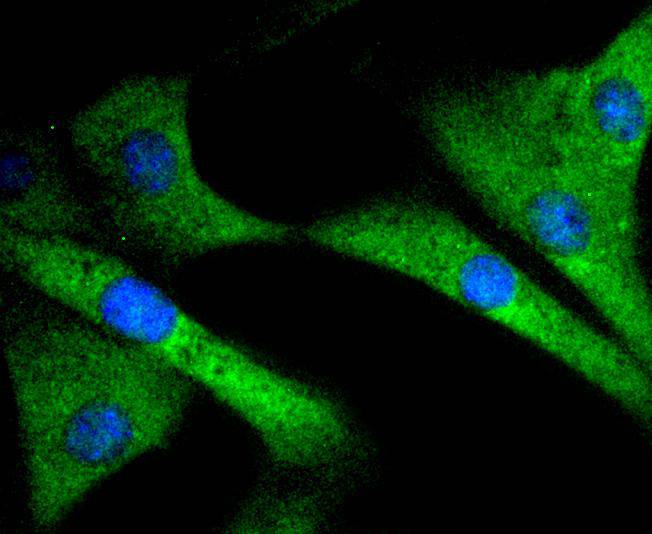 SIRT1 Rabbit mAb