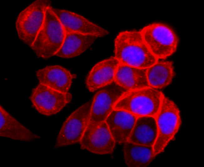 EGFR Rabbit mAb