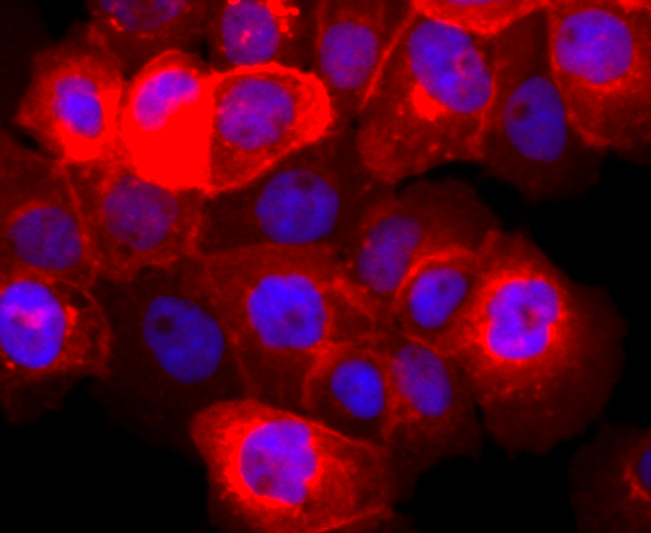 EGFR Rabbit mAb