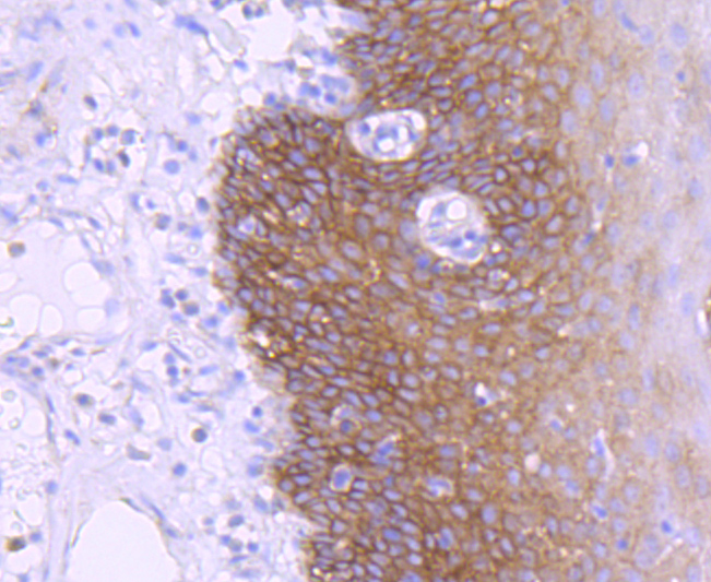 EGFR Rabbit mAb