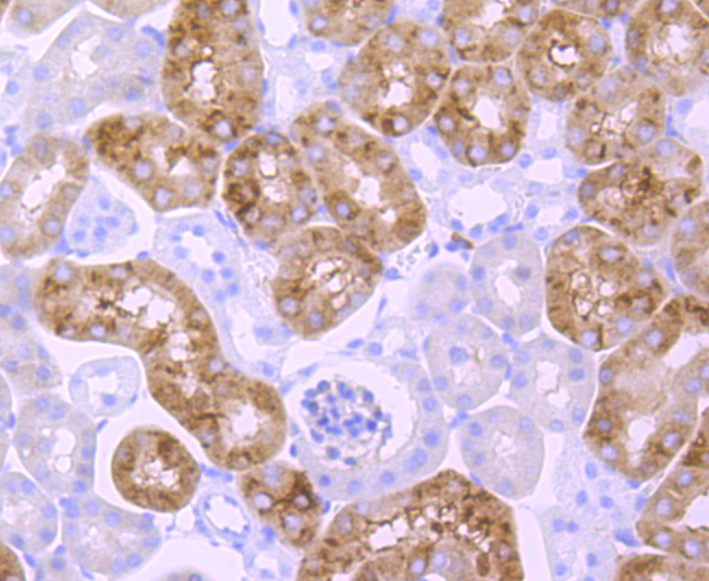 EGFR Rabbit mAb