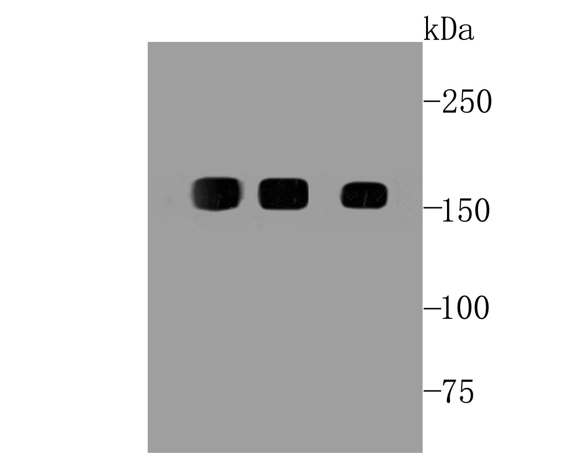 EGFR Rabbit mAb