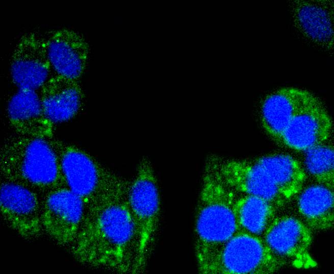 AIF Rabbit mAb