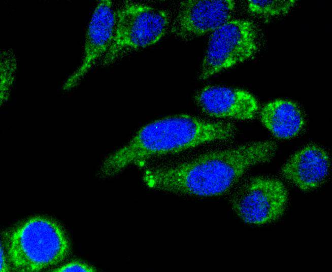 AIF Rabbit mAb