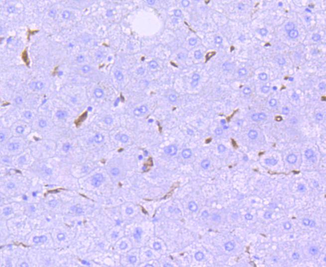 Heme Oxygenase 1(HO-1) Rabbit mAb