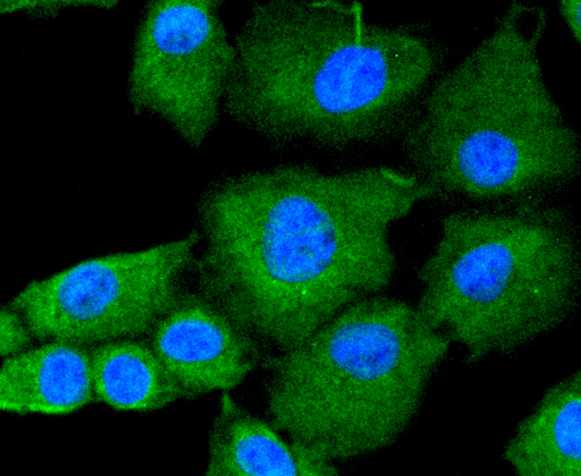 JAK2 Rabbit mAb