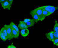 JAK2 Rabbit mAb