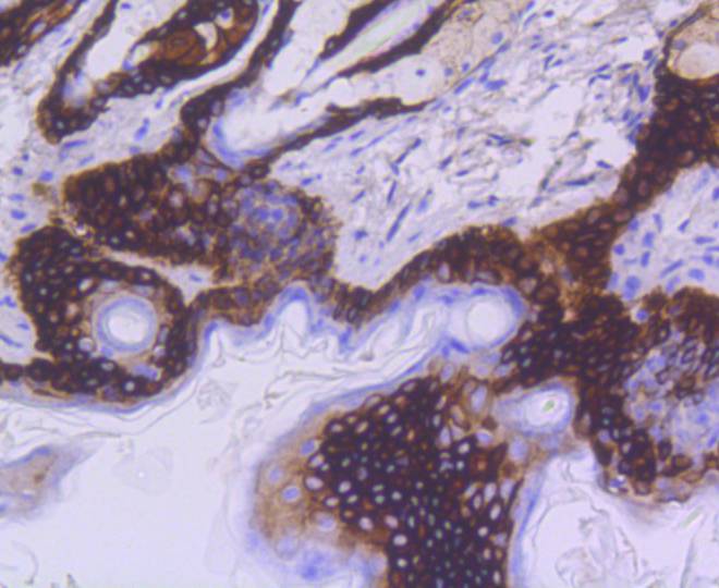 Cytokeratin 15 Rabbit mAb