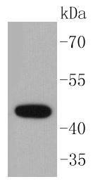 Cytokeratin 15 Rabbit mAb