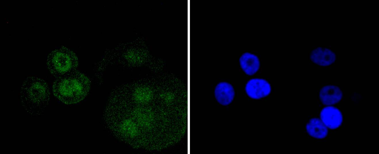 p73 Rabbit mAb