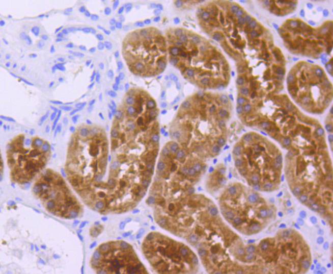 p73 Rabbit mAb