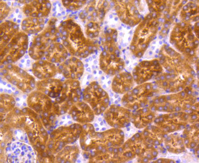 p73 Rabbit mAb