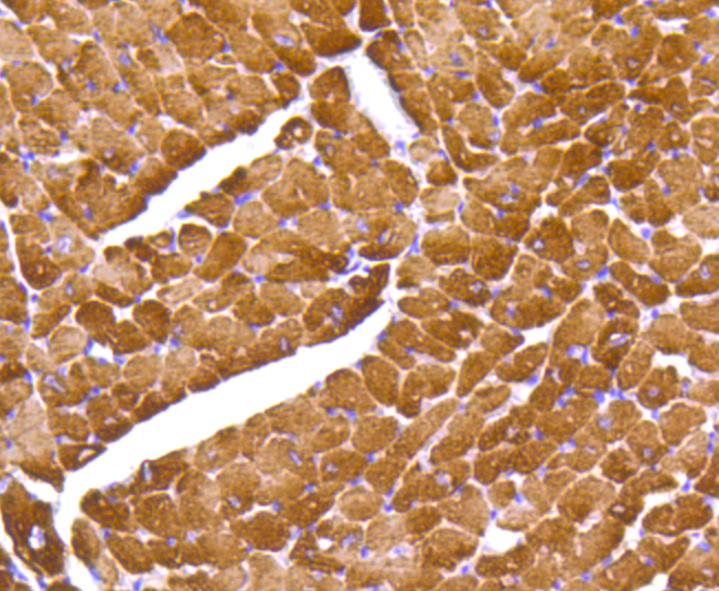 Myosin Light Chain 2 Rabbit mAb