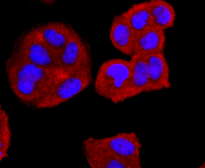 CD74 Rabbit mAb