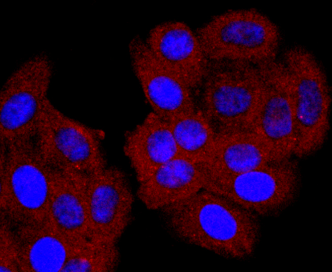 CD74 Rabbit mAb