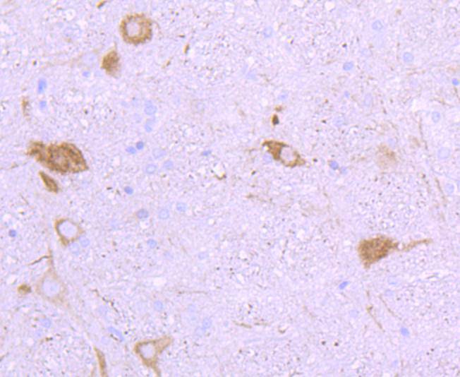 Neurofilament heavy polypeptide Rabbit mAb