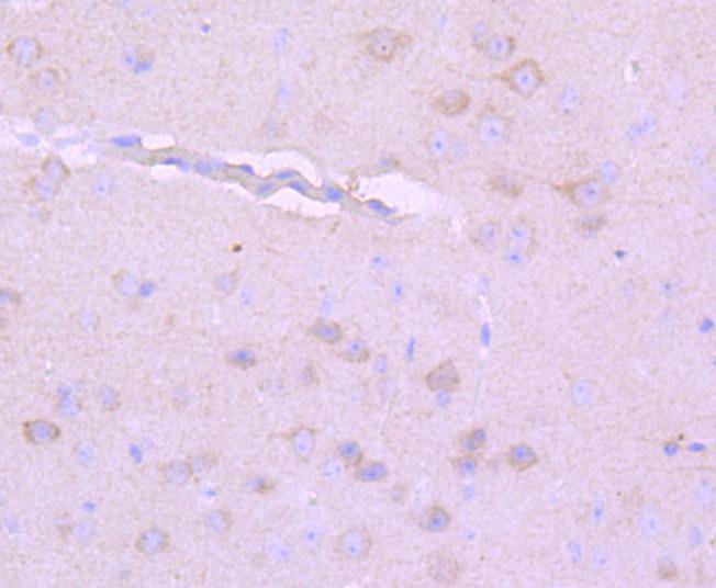 Neurofilament heavy polypeptide Rabbit mAb